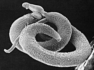 schistosomiasis organizmus